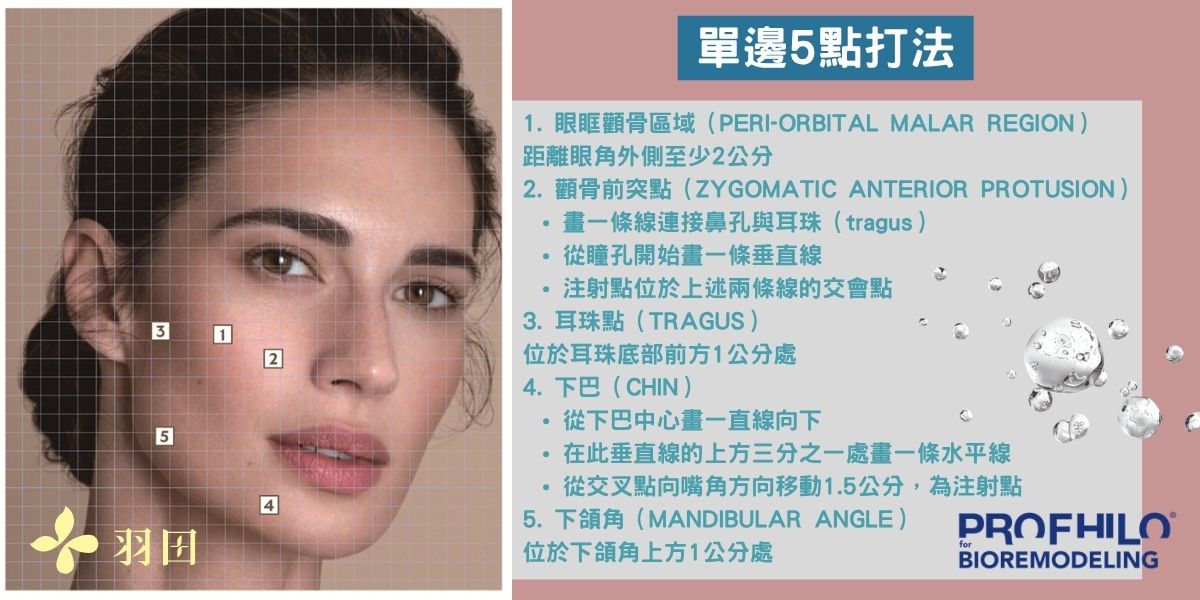 逆時針醫美單邊5點打法