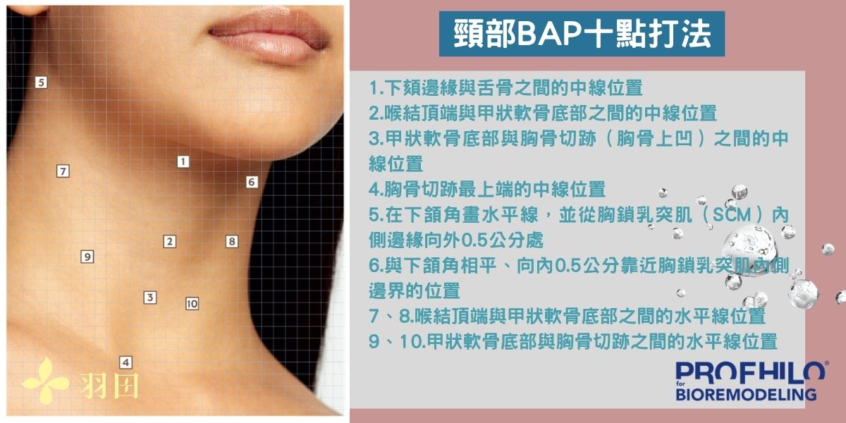 頸部 BAP 10點注射位置說明