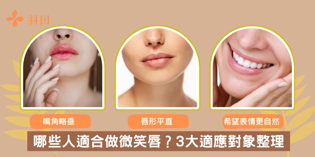 哪些人適合做微笑唇?3大適應對象整理