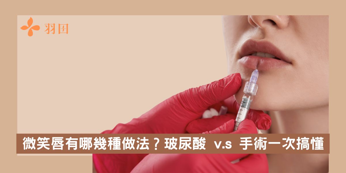 微笑唇有哪幾種做法?玻尿酸 v.s 手術一次搞懂