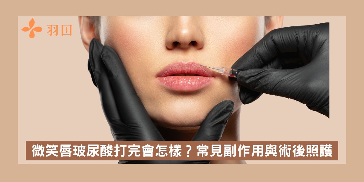 微笑唇玻尿酸打完會怎樣?常見副作用與術後照護