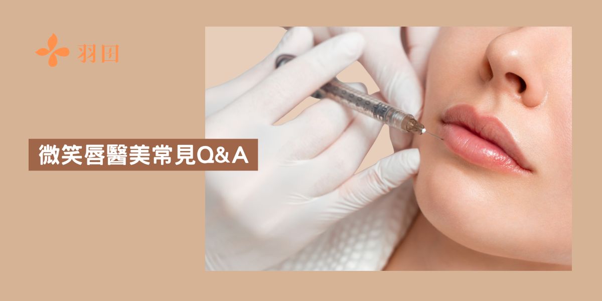 微笑唇醫美常見Q&A