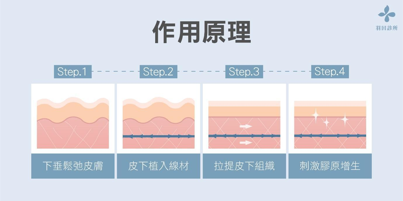 臉部埋線如何固定肌膚？打造穩定支點