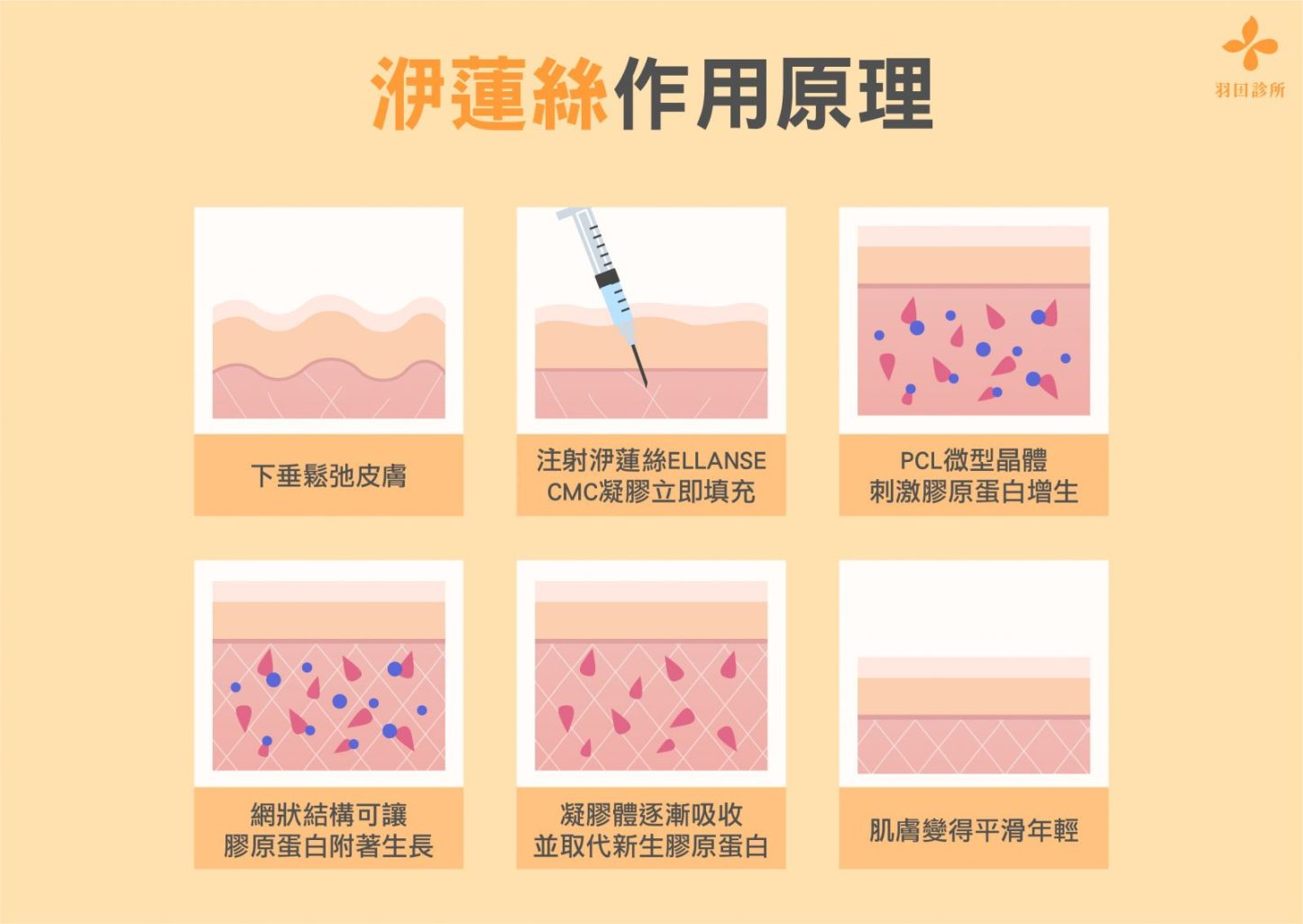 洢蓮絲｜深層輪廓固定與提升骨性支撐