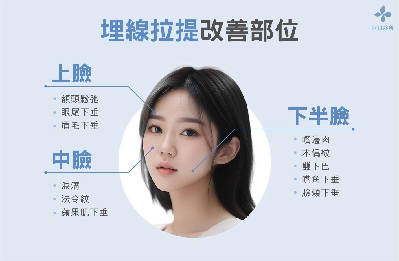 臉部埋線改善部位