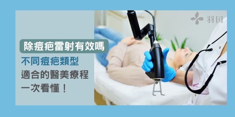 除痘疤雷射有效嗎?不同痘疤類型適合的醫美療程一次看懂!