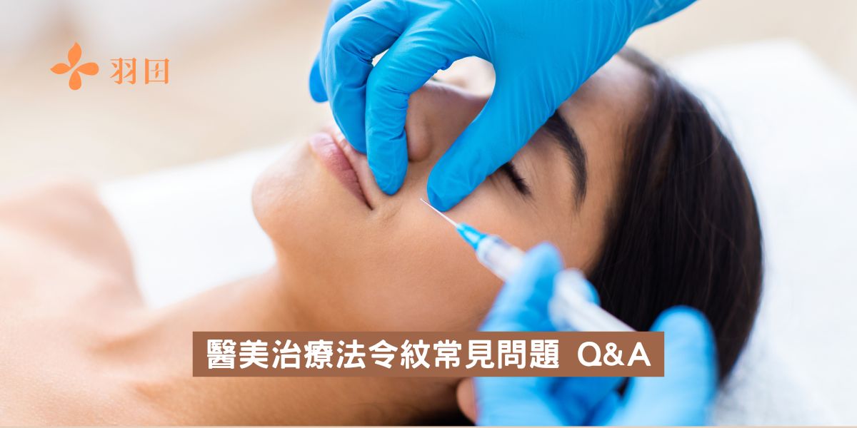 醫美治療法令紋常見問題 Q&A