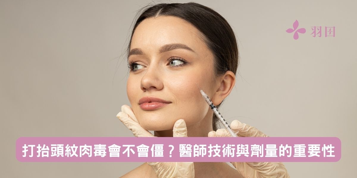 打抬頭紋肉毒會不會僵?醫師技術與劑量的重要性
