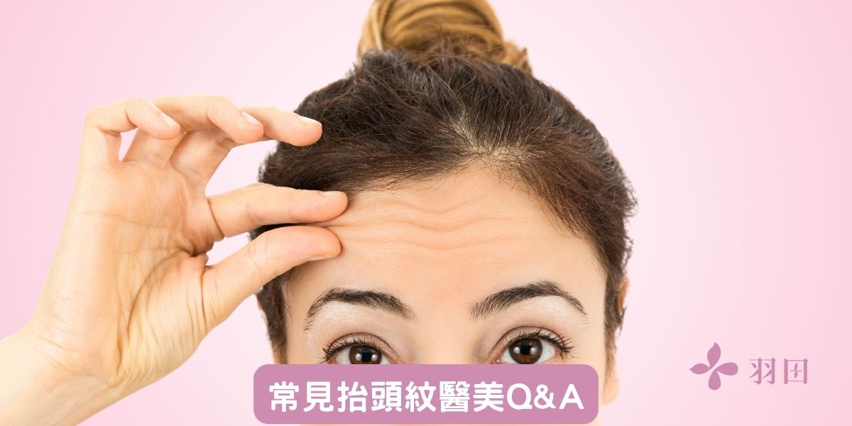 常見抬頭紋醫美Q&A