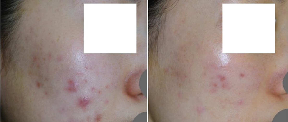 清新光案例分享