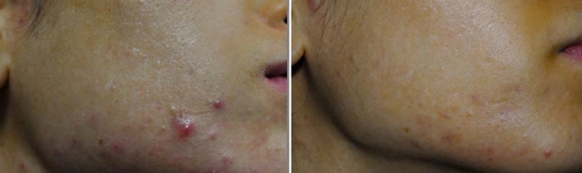 清新光案例分享