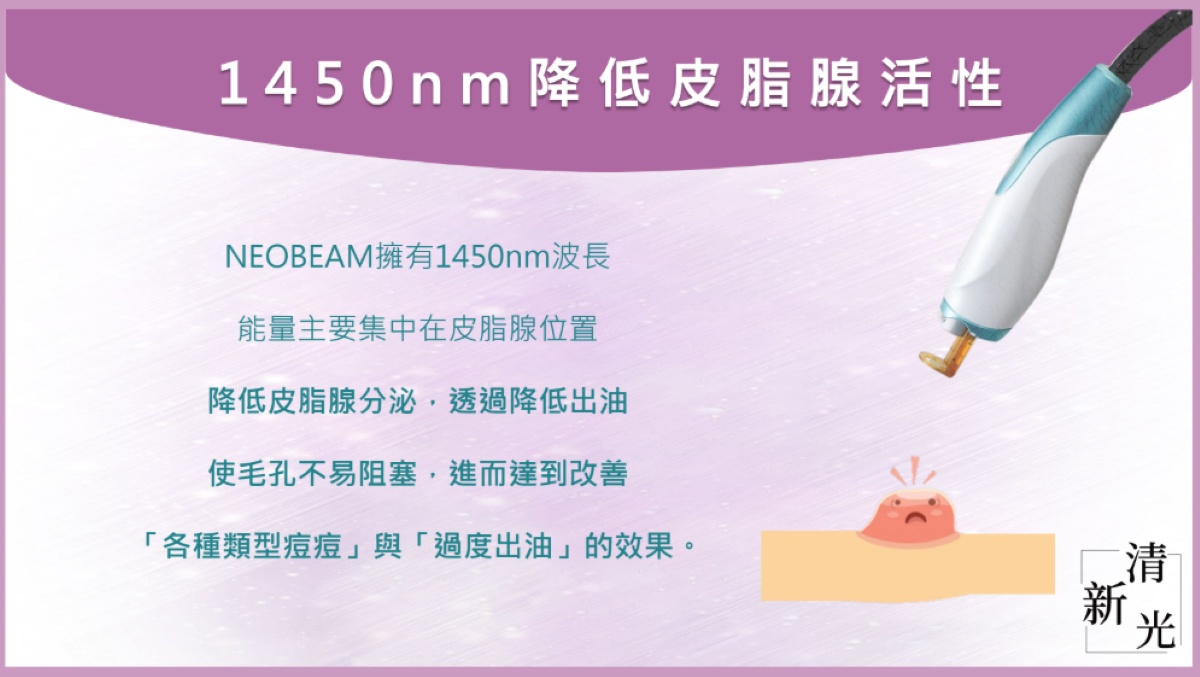 1450nm波長直達皮脂腺