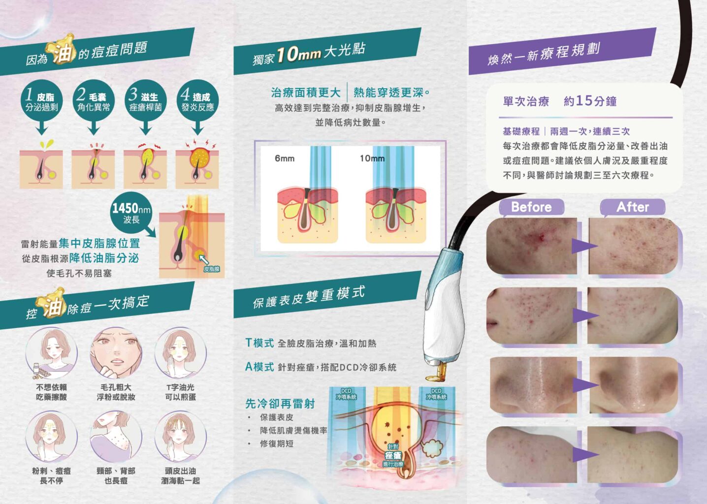新清光獨家亮點,改善你的油肌痘肌!