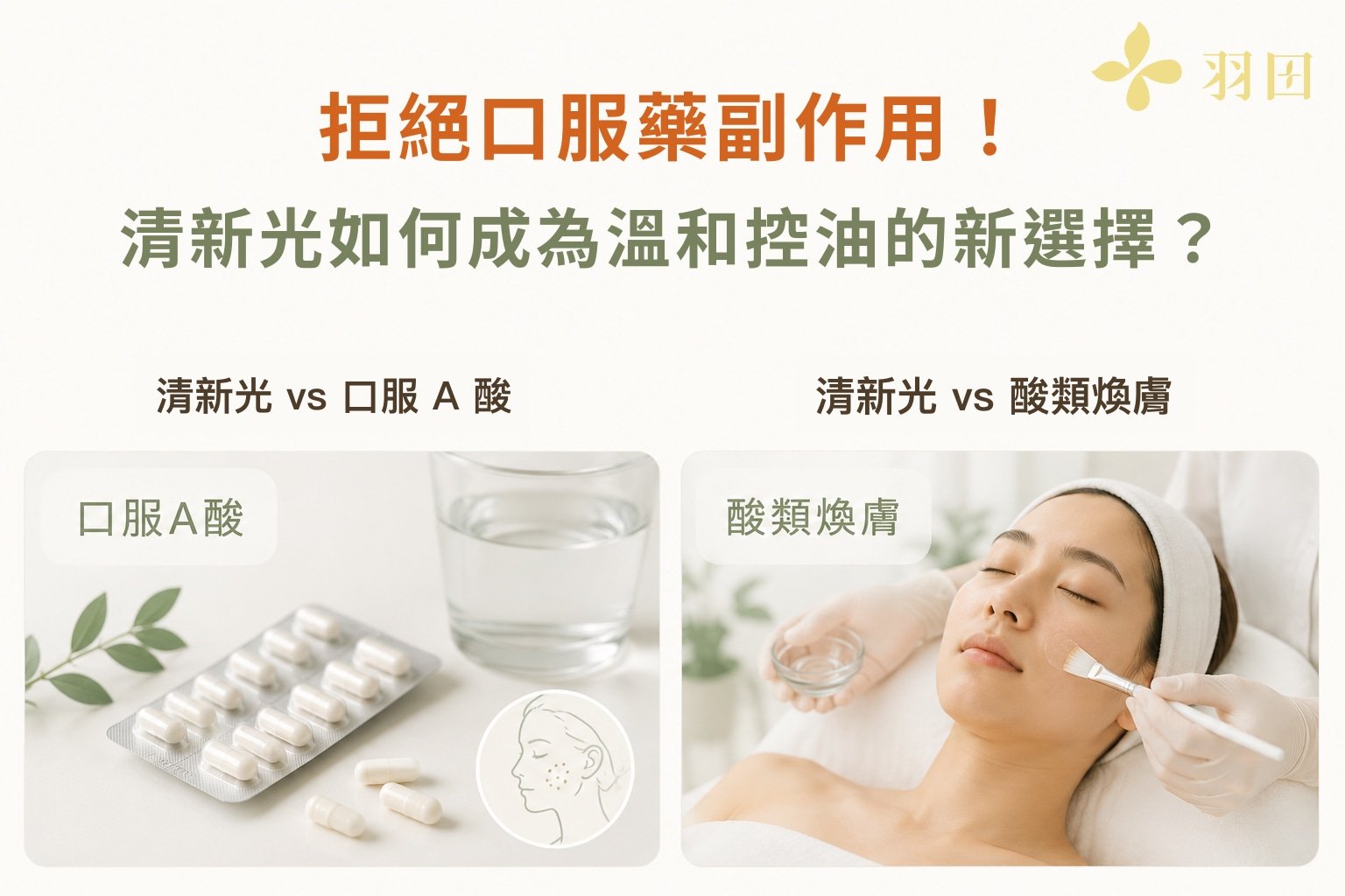 控油方式比較圖，比較清新光與口服 A 酸、酸類煥膚在安全性、舒適度與作用層次上的差異