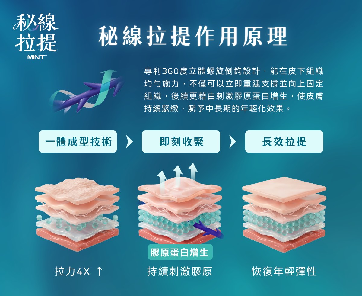 秘線拉提 360 度立體螺旋倒鉤設計示意
