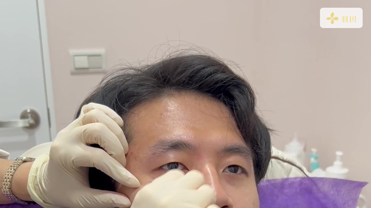 消防員個案躺在療程椅上,醫護人員戴手套進行施作前準備